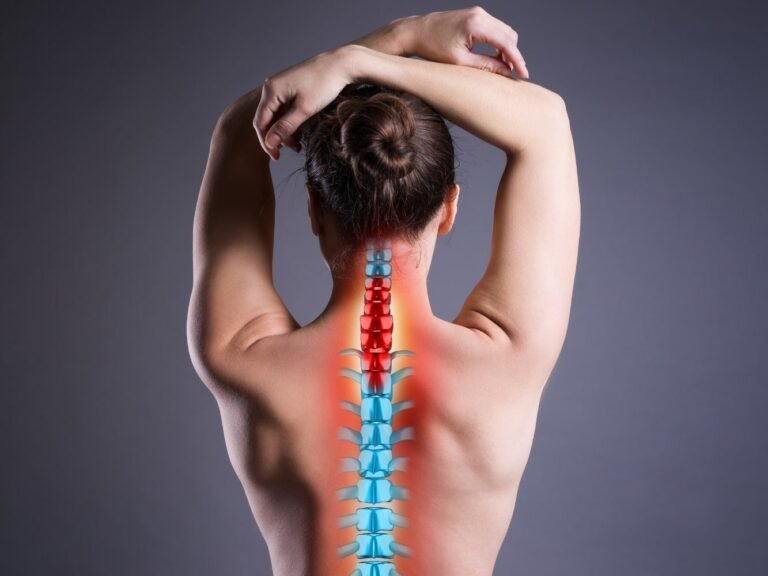 animación de mujer con hernia discal en el cuello