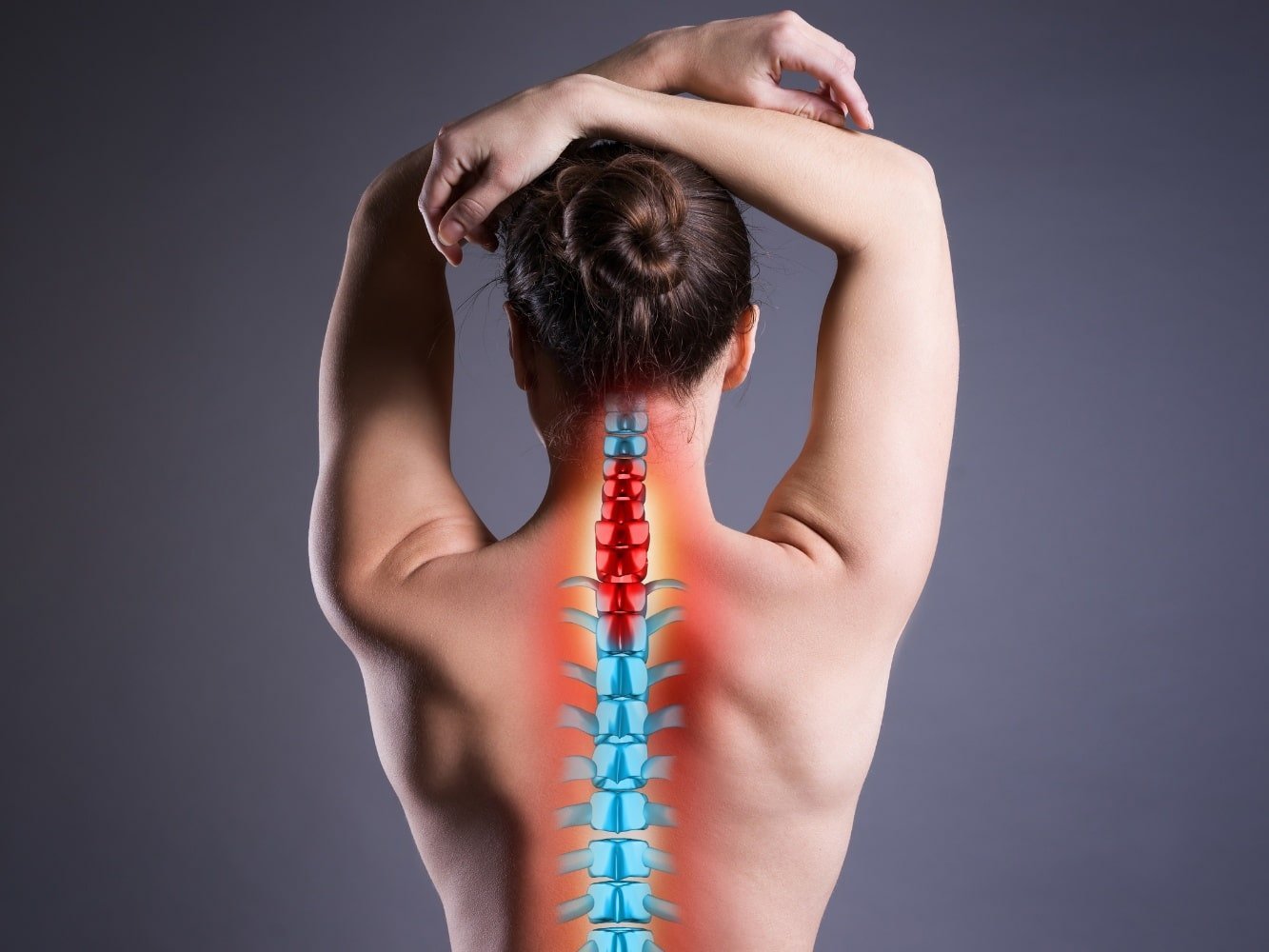 animation of woman with herniated disc in neck