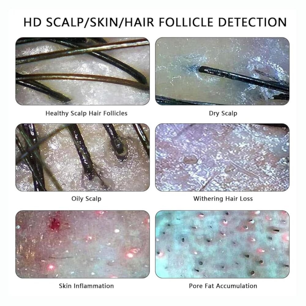 Dispositif d'analyse du cuir chevelu