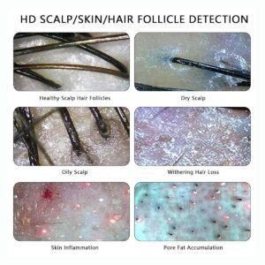 Dispositif d'analyse du cuir chevelu