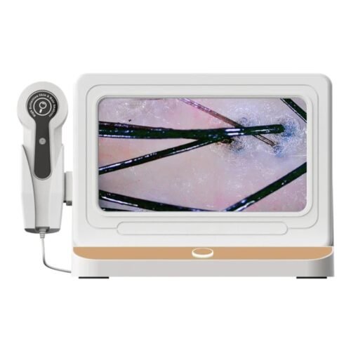 Scalp Analysis Device