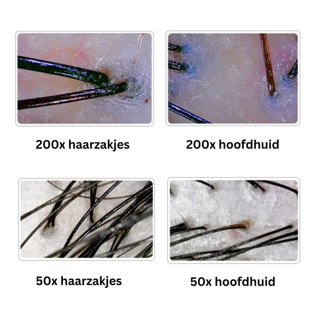 Dispositif d'analyse du cuir chevelu