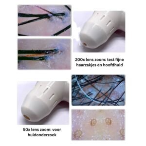 Dispositif d'analyse du cuir chevelu