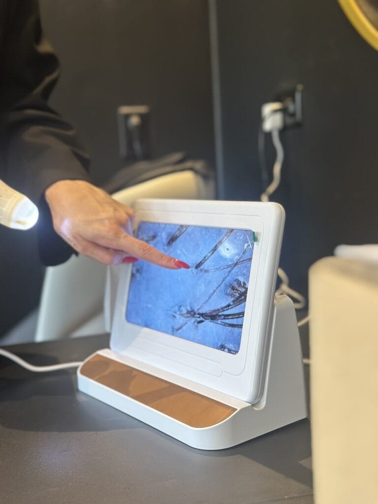 Hoofdhuidanalyse met de Head Spa scan